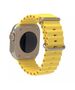 Techsuit Curea pentruApple Watch 1/2/3/4/5/6/7/8/SE/SE 2 (38/40/41mm) - Techsuit Watchband (W038) - Yellow 5949419015265 έως 12 άτοκες Δόσεις